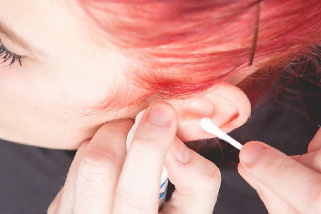 How To Heal Your New Piercings: Expert Tips for Speedy Healing