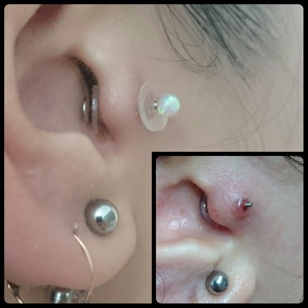 NoPull Piercing Disc®️ is THE Solution for Hypertrophic Scarring