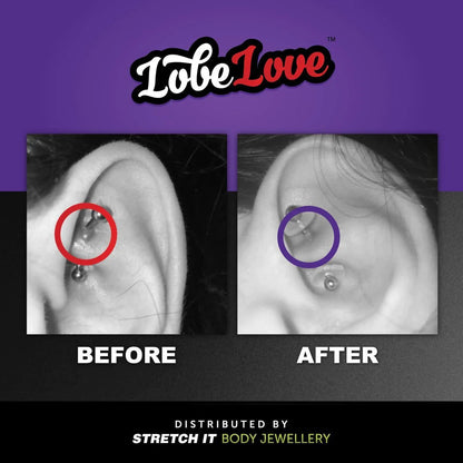 LobeLove Silicone No Pulling Piercing Disc Healing Bumps - Pierced n Proud
